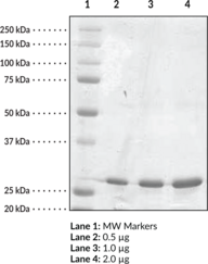 Serum Retinol Binding Protein 4 (human recombinant)