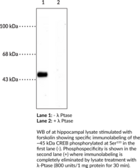 CREB (Phospho-Ser<sup>133</sup>) Polyclonal Antibody