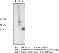 PINK1 Monoclonal Antibody