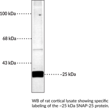 SNAP-25 Polyclonal Antibody