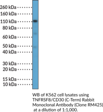 TNFRSF8/CD30 (C-Term) Rabbit Monoclonal Antibody