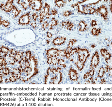 Prostein (C-Term) Rabbit Monoclonal Antibody