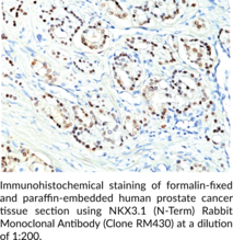 NKX3.1 (N-Term) Rabbit Monoclonal Antibody