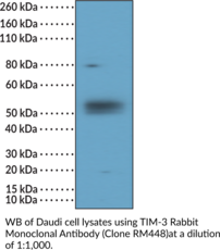 TIM-3 Rabbit Monoclonal Antibody