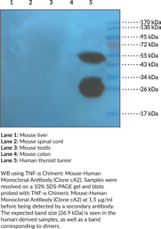 TNF-? Chimeric Mouse-Human Monoclonal Antibody (Clone cA2)